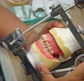 The Wax try-in for new denture